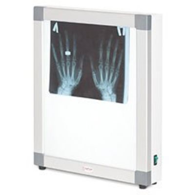 Негатоскопы 